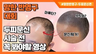 망한 반영구 대회 첫번째손님, 두피문신.. 이래도 되는거야??!!?...