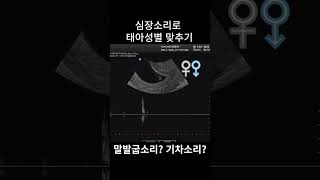 심장소리로 태아 성별 맞추기 ! #shorts