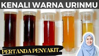 Ciri Warna Urine/Air Kencing/Seni TANDA Gangguan Kesehatan/Penyakit