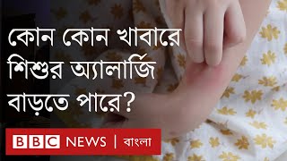 খাদ্যে অ্যালার্জি বাড়ছে বিশ্বজুড়ে, কেন বাড়ছে? এমন অ্যালার্জি থেকে মুক্তির উপায় কী?