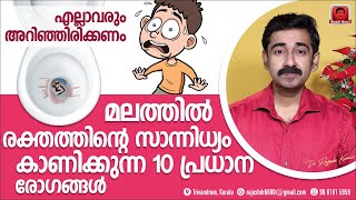 മലത്തിൽ രക്തം കാണുന്ന 10 പ്രധാന രോഗങ്ങൾ. എല്ലാവരും സ്വയം അറിഞ്ഞിരിക്കുന്നത് നല്ലതാണ്