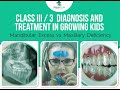 Class 3 Diagnosis and Treatment Planning Growing Kids: Mid Face Deficiency vs Mandibular Prognathism