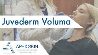 Juvederm Voluma FAQ