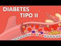 Diabetes tipo 2 - Explicada Fácilmente Para Pacientes