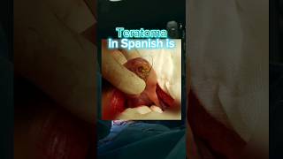 TERATOMA in SPANISH | Excel in Medical Consecutive Interpretation