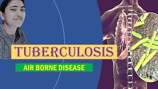 TUBERCULOSIS II MEDICAL MICROBIOLOGY II AIR-BORNE DISEASE