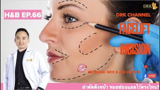 Health \u0026 Beauty EP66  ผ่าตัดดึงหน้า หมอซ่อนแผลไว้ตรงไหน?