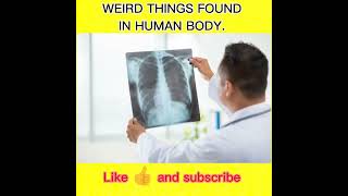 Weird things found in Human Body.#short #trending #facts #fun #viral #shortsfeed