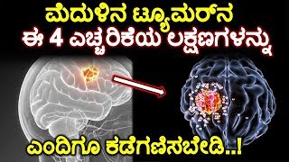 ಮೆದುಳಿನ ಟ್ಯೂಮರ್‌ನ ಈ 4 ಎಚ್ಚರಿಕೆಯ ಲಕ್ಷಣಗಳನ್ನು ಎಂದಿಗೂ ಕಡೆಗಣಿಸಬೇಡಿ..!