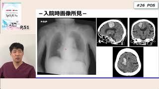SpO2低下編_#26　POS