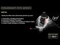 echocardiography board review mcq 4 echocardiogram