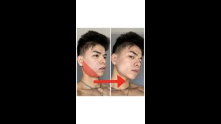 How Do I Get A Sharper Jawline Without Surgery