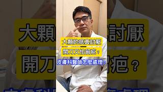 大顆的痣真討厭！開刀又怕留疤？#皮膚科醫師 怎麼處理 #吳仁欽皮膚科診所 #屏東醫美 #屏東微整 #567 #除痣 #雷射除痣 #息肉 #增生組織 #氣化雷射 #老人斑 #垂疣 #病毒疣