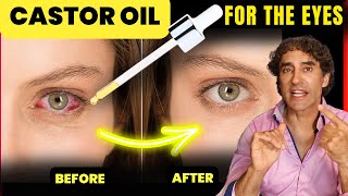 Castor Oil  // Dry Eye, Dark Circles, Cataracts, Floaters and MORE!!