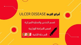 قسم التخدير \ المرحلة الثانية / اسس الجراحة | Ulcer Disease امراض القرحة