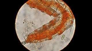 Copepod (Harpacticoida)