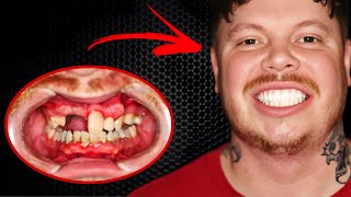 How I (and you) Can Get $50,000 Teeth For Free!