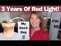 Let Me Show You My Results From Using Red Light For 3 Years!!