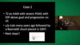 Expert Roundtable: Glaucoma Case Studies