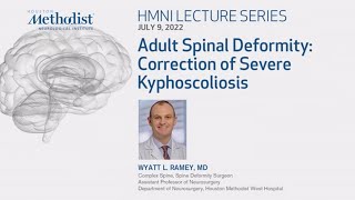 Adult Spinal Deformity  Correction of Severe Kyphoscoliosis