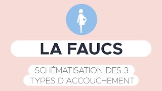 FAUCS -  Présentation pratique des 3 types d'accouchement