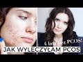 Jak naturalnie wyleczyłam PCOS (Zespół Policystycznych Jajników) | 3 kroki! Bez hormonów!