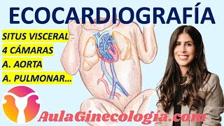 ECOCARDIOGRAFÍA FETAL: SITUS VISCERAL, 4 CÁMARAS, GRANDES VASOS... - Ginecología y Obstetricia -