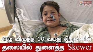 கீழே விழுந்த 10 வயது சிறுவனின் தலையில் துளைத்த Skewer | #America | #Skewer