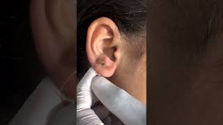 Ear Piercing without Pain | Painless Earlobes Piercing at Skinaa Clinic #viral #shorts