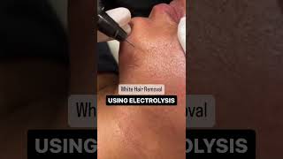 Electrolysis Hair Removal