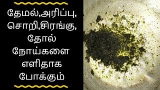 தேமல்,அரிப்பு,சொறி,சிரங்கு, தோல் நோய்களை வீட்டிலே குணப்பெடுத்தலாம்