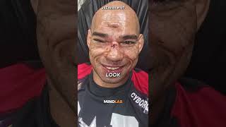 The Worst Injury In UFC History