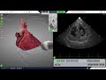 Using the Probes - HeartWorks Module 9