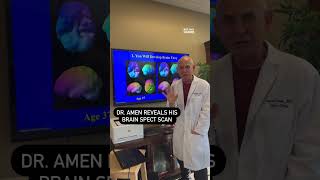 Dr. Daniel Amen Reveals His Brain Scan