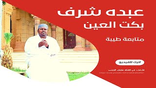 بكت العين || عبده شرف || مديح سوداني