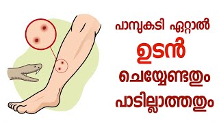 പാമ്പുകടിയേറ്റാൽ ജീവൻ രക്ഷിക്കാൻ ഇതുമാത്രം ചെയ്താൽ മതി |Snake bite,what should be done immediately?