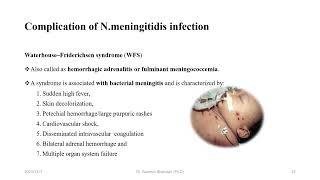 Neisseria meningitidis