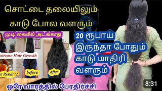 💁உதிர்ந்து போன உங்கள் முடியை  மறுபிறவி எடுக்க வைக்கும் சீக்ரெட் பொருள் hair growth tips useful#hair