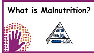 What is Malnutrition?