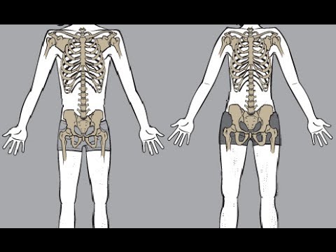 Bodybuilding Genetics? Bodybuilding Genetics?
