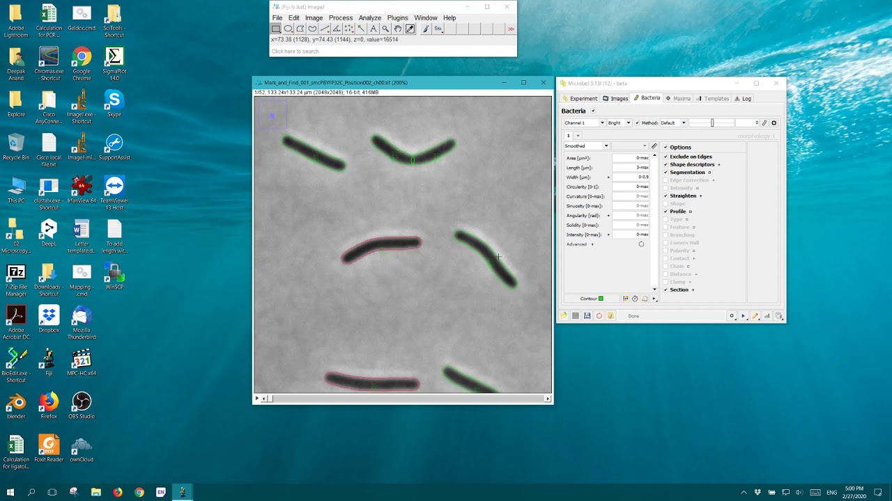 Cell Detection Using Microbej Youtube