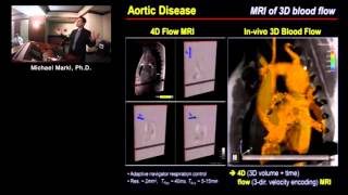 Recent Advances in Cardiovascular Magnetic Resonance Imaging (Michael Markl, Ph.D.) Nov. 19, 2015