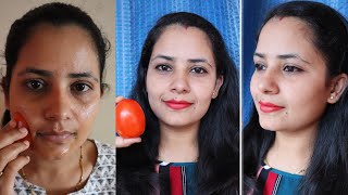 5 मिनट में चेहरा साफ़ और गोरा करने के घरेलू उपाय Gora hone ka tarika | Skin Whitening