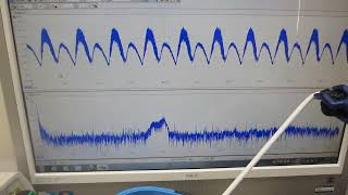 超音波プローブの特性評価テスト（超音波システム研究所）