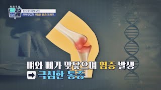 한 번 닳은 연골은 재생 불가❌ '관절염' 통증의 원인은? | 닥터들의 썰왕썰래 15회 | JTBC 220930 방송