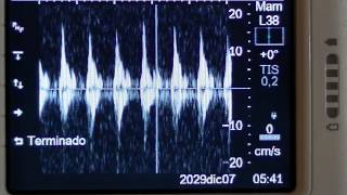 Sonosite 180 Plus _b