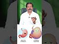 வாயுத்தொல்லை இனி கவலை இல்லை gastric problem home remedy dr.rk akshayan