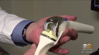 "Smart knee" designed to improve recovery after surgery