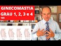 GINECOMASTIA - Explicando os 4 graus da MAMA MASCULINA [Cirurgia Plástica]