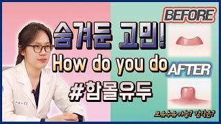 제니스TV - 숨겨둔 고민! How do you do #함몰유두